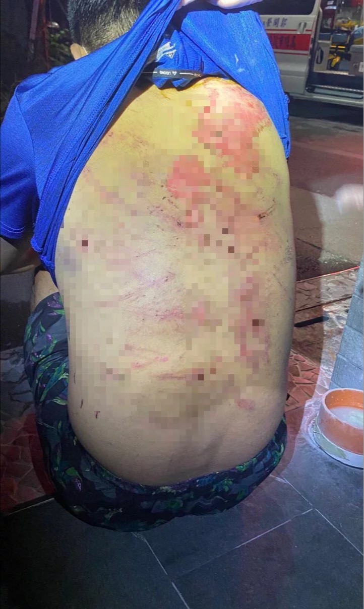 被押走虐打的胡男因路倒被警方發現全身是傷，背部有大片毆傷及燒燙傷。（翻攝畫面）