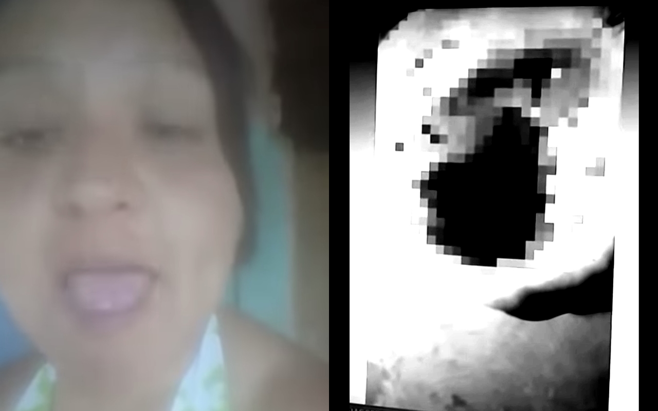 巴西一名女子為了避免被性侵，情急之下一口咬掉了前男友的睪丸。（翻攝自Clique União YouTube）