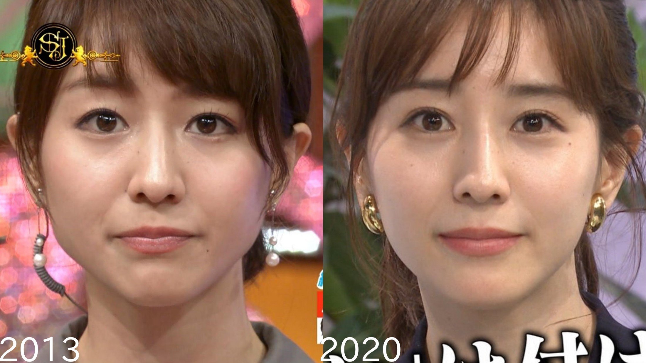 網友挖出田中美奈實舊照與現在的照片對比，質疑她「不夠天然」。（翻攝自推特@m_rfis___）