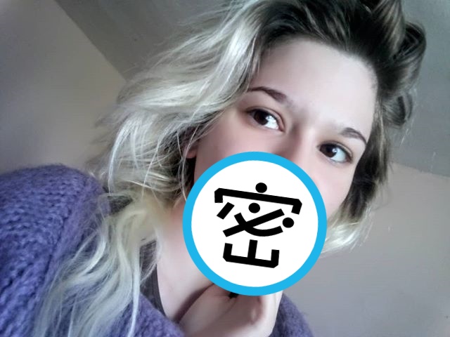 伊凡諾娃迷戀芭比娃娃的豐唇，歷經21次玻尿酸注射，上嘴唇已經頂到鼻子。（翻攝自伊凡諾娃IG）