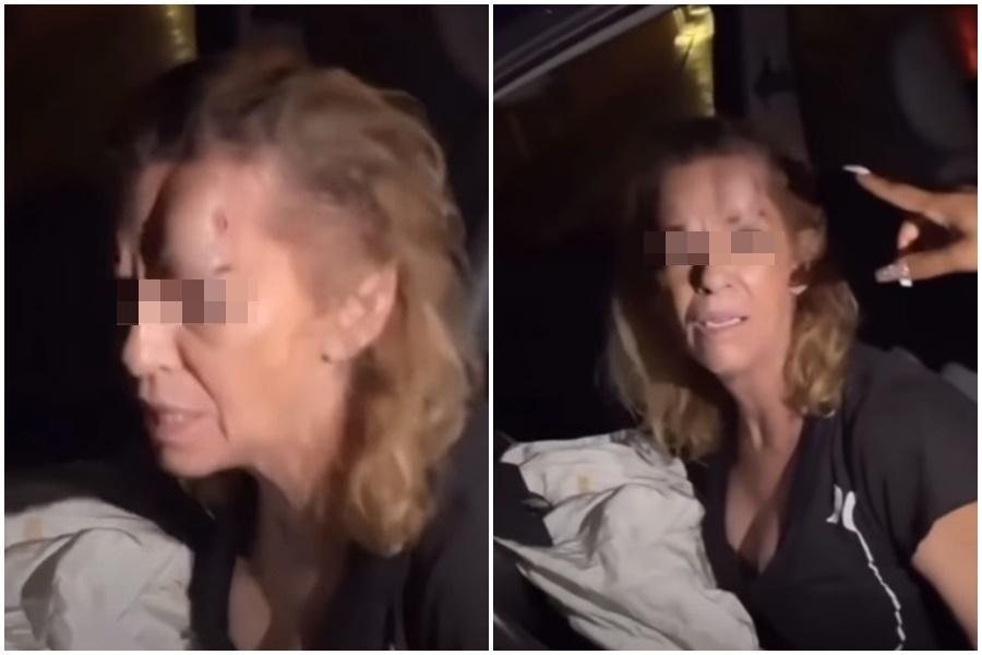 女駕駛額頭腫的像第2顆屁股,網友們看完除了驚訝之外多的是爆笑。(翻攝自 B.C.&Lowy YouTube頻道)