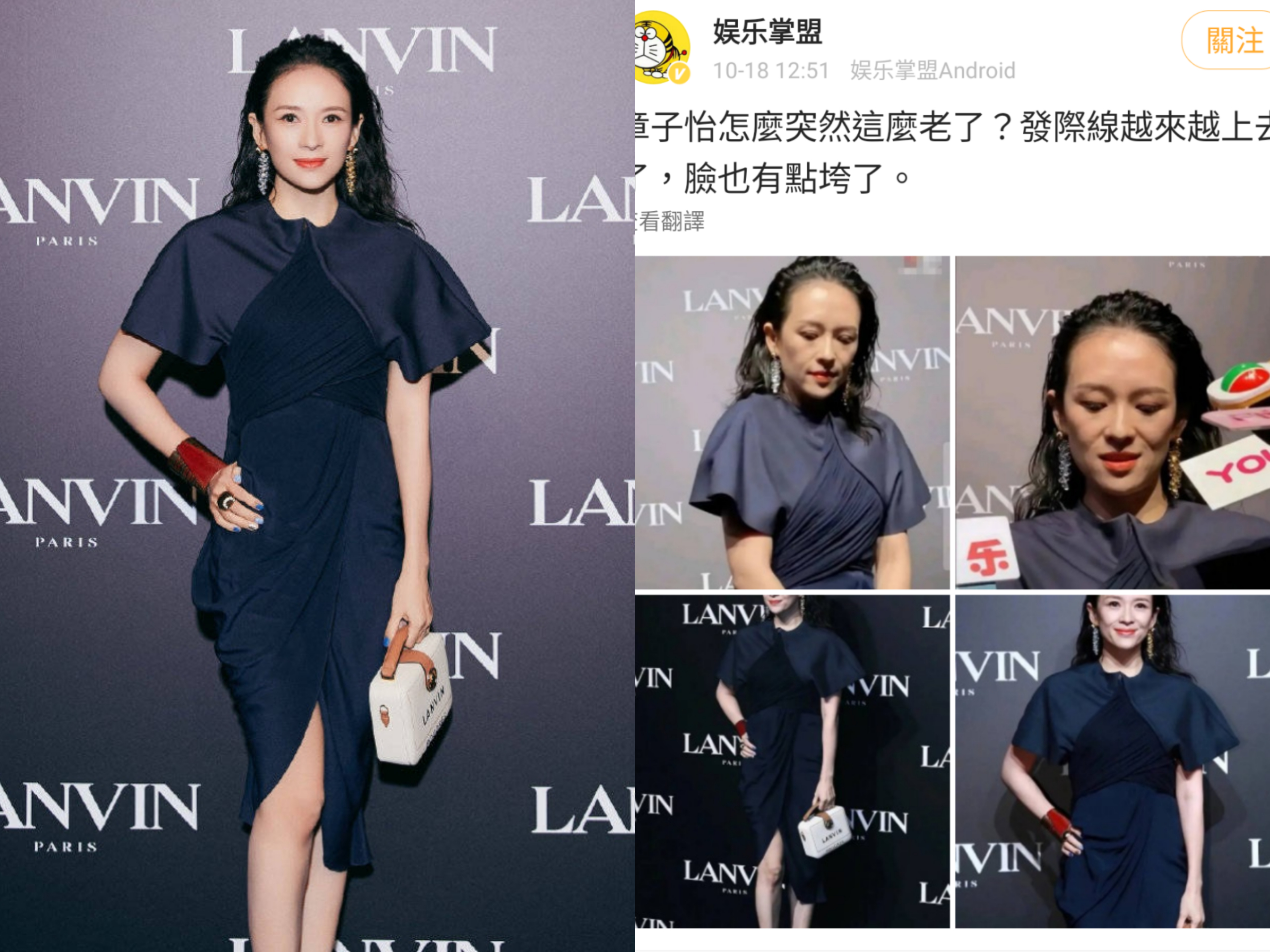 章子怡參加時尚活動， 官方圖巨星氣場強，網友卻發現她的髮際線有後退危機。（LANVIN微博／翻攝自娛樂掌盟微博）