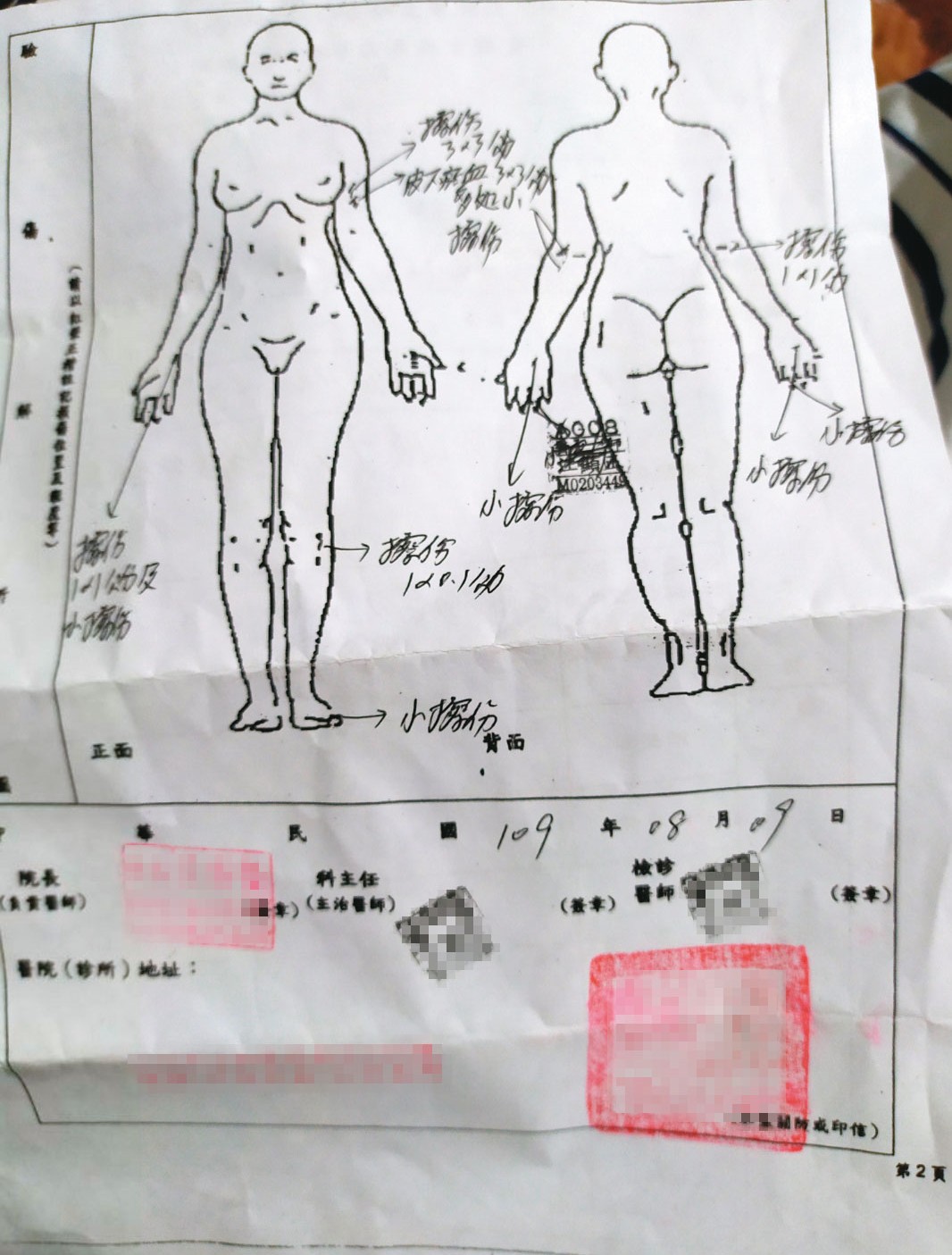 被害人H小姐事後赴醫院驗傷，並對男友提出傷害告訴。（讀者提供）
