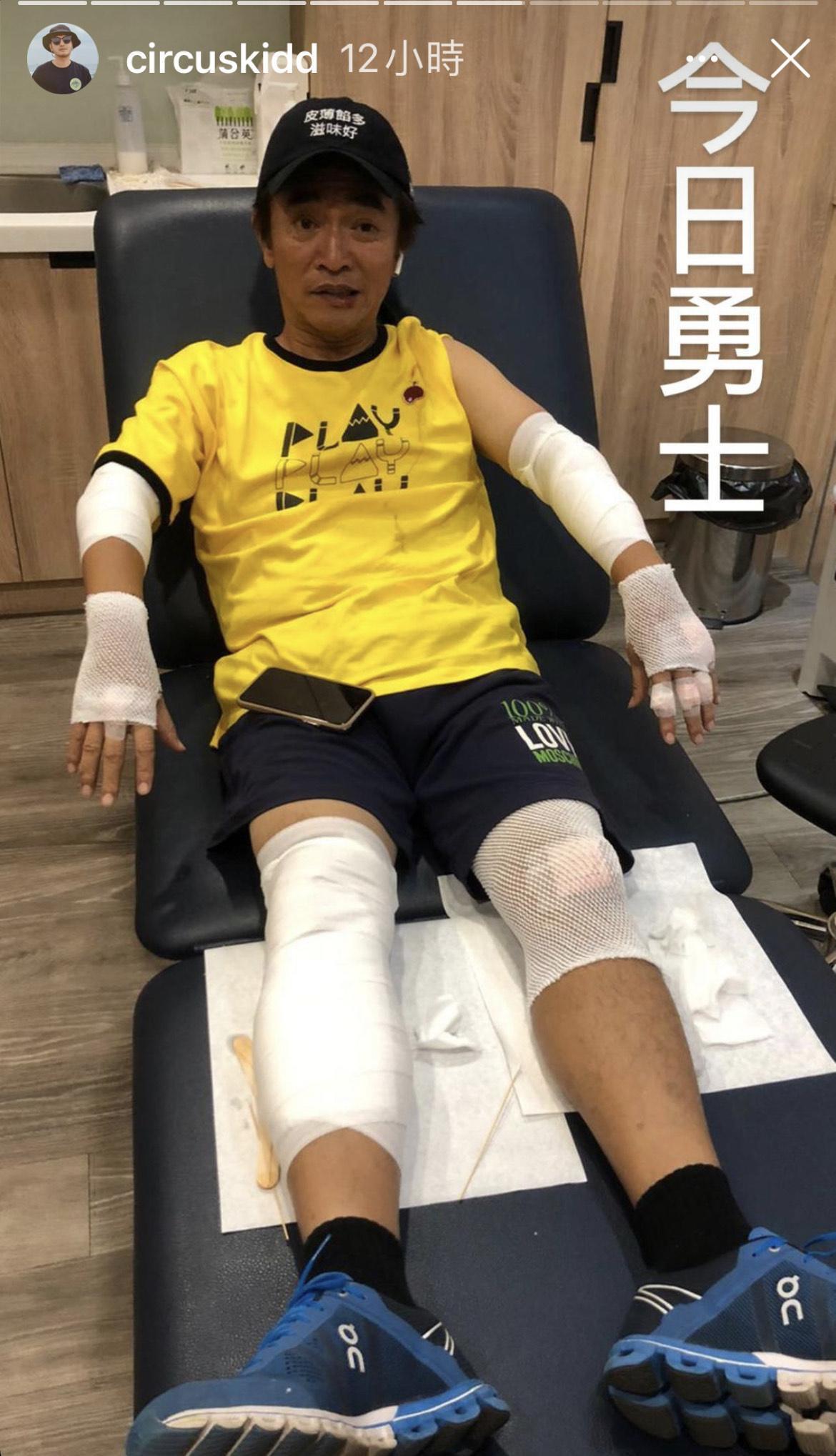 見吳宗憲受傷仍精神奕奕，KID稱他是「今日勇士」。（翻攝自吳宗憲IG）