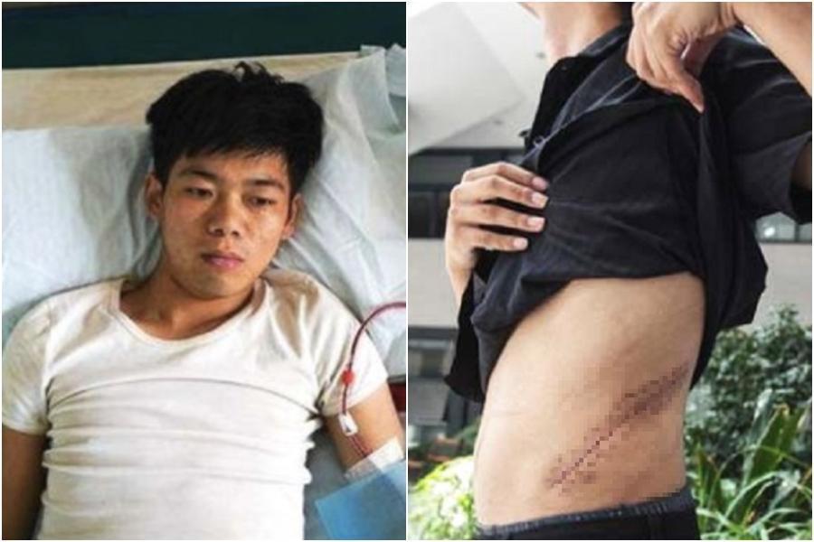 王剛17歲時因想要iPhone 4S將自己的一顆腎臟賣掉,超慘現況被曝光。(翻攝自微博)