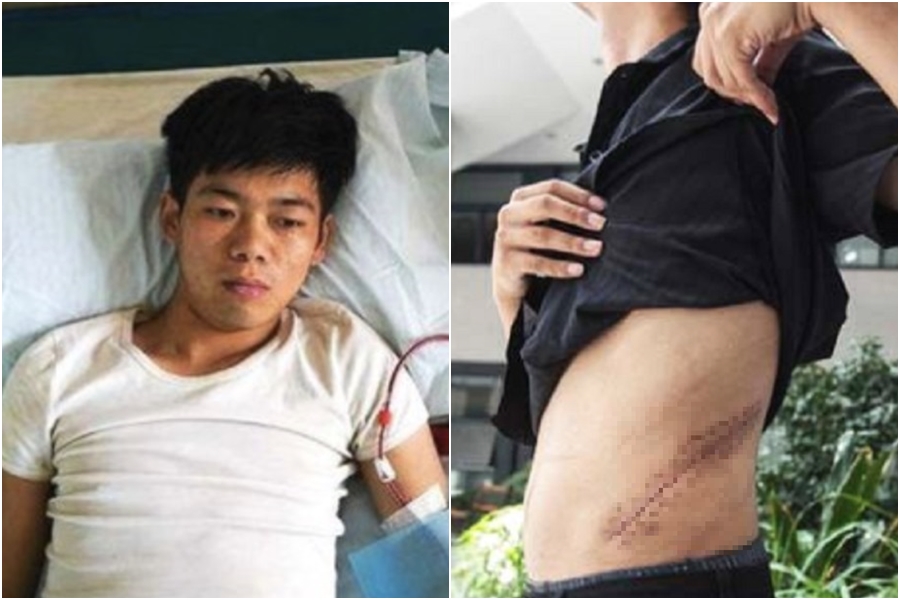 王剛17歲時因想要iPhone  4S將自己的一顆腎臟賣掉，超慘現況被曝光。（翻攝自微博）