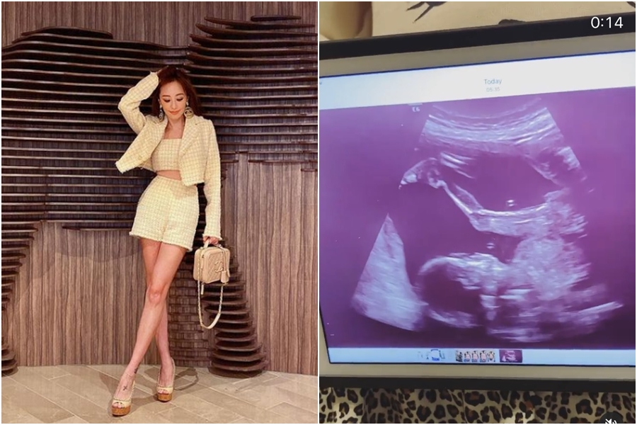關穎在IG曬出超音波照報喜，引起朋友們留言恭喜她懷上第四胎。（翻攝自關穎IG）