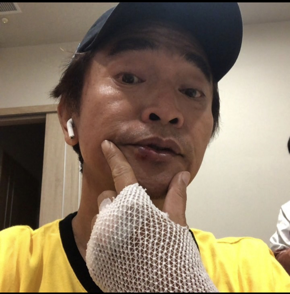 吳宗憲一早接受電腦斷層掃描,還好除了輕微腦震盪與皮肉傷,其他大致無礙。(翻攝自吳宗憲IG)