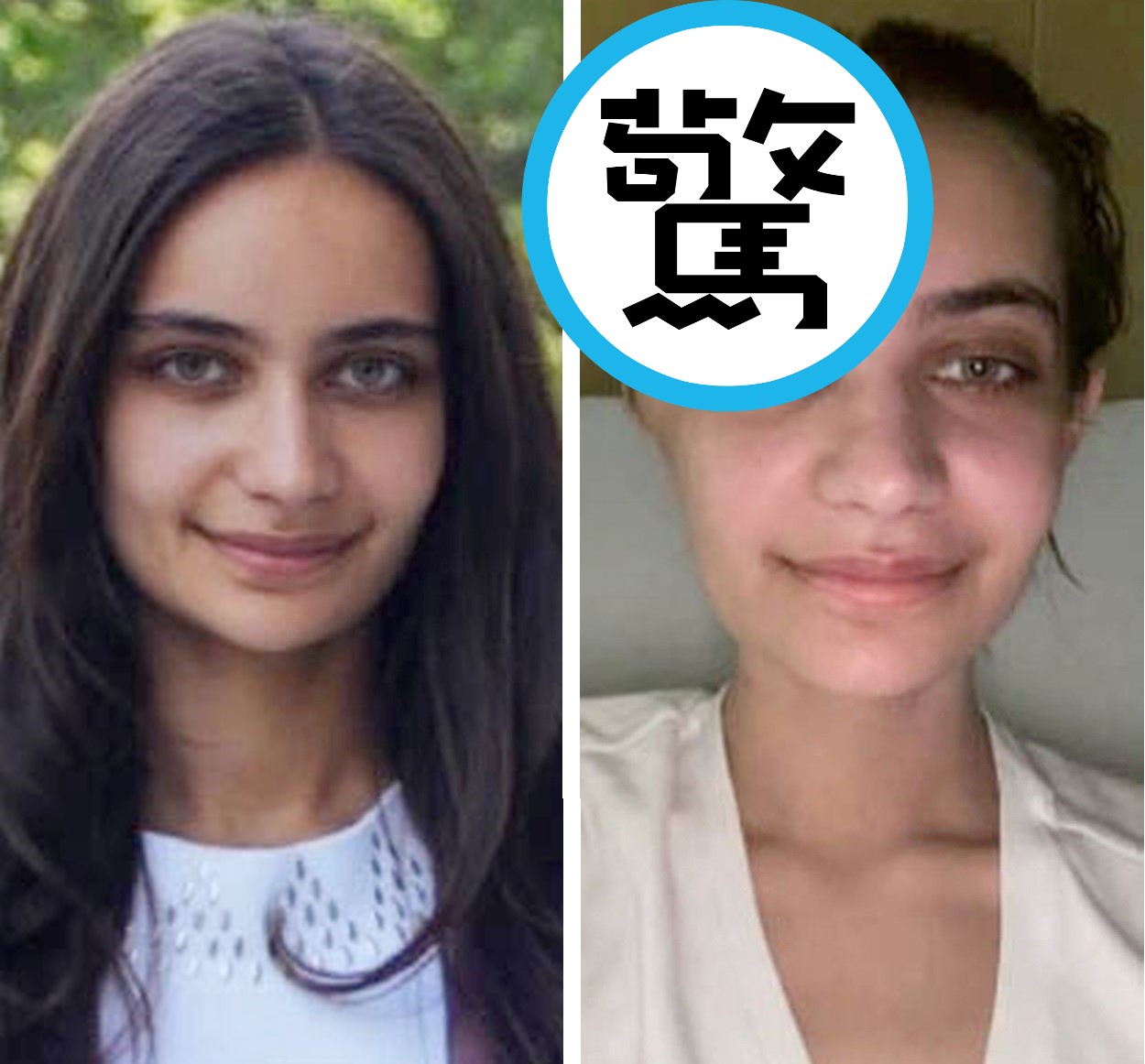 沉重的木頭躺椅從12樓墜下，砸中24歲的安娜貝爾。（翻攝自莫雷利律師事務所）