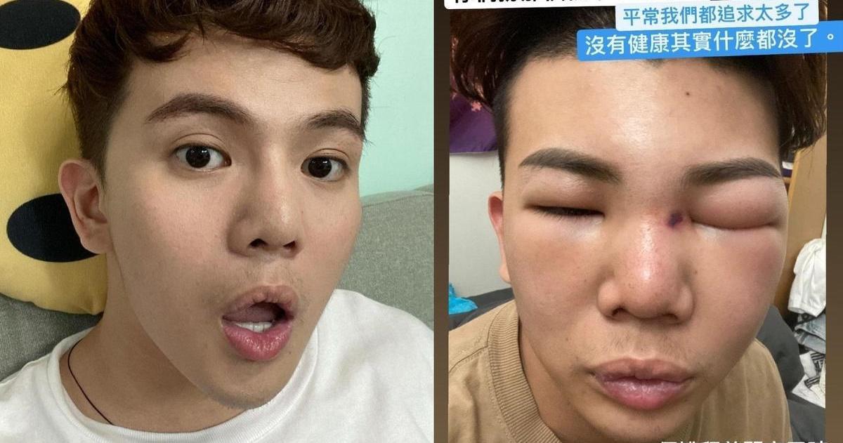 孫生月初自曝身體不適停工,日前拍影片還原當時真相。(翻攝自孫生IG)