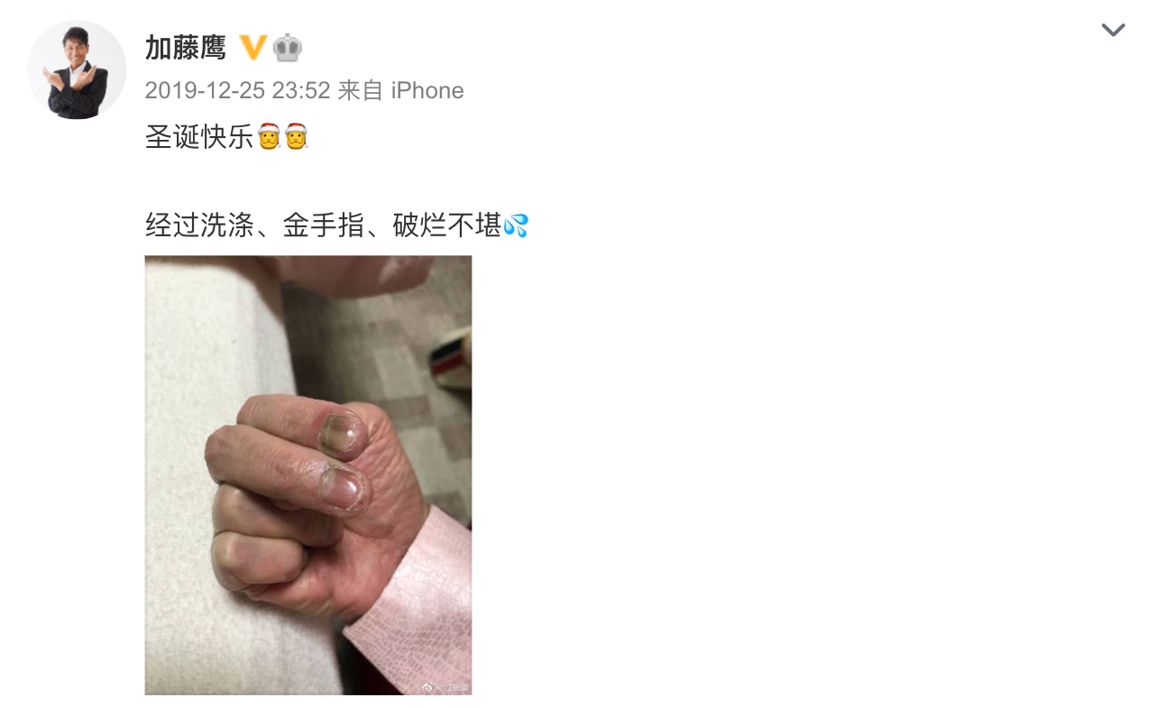 加藤鷹去年聖誕節放上發黑紅腫的金手指照片。（截圖加藤鷹微博）
