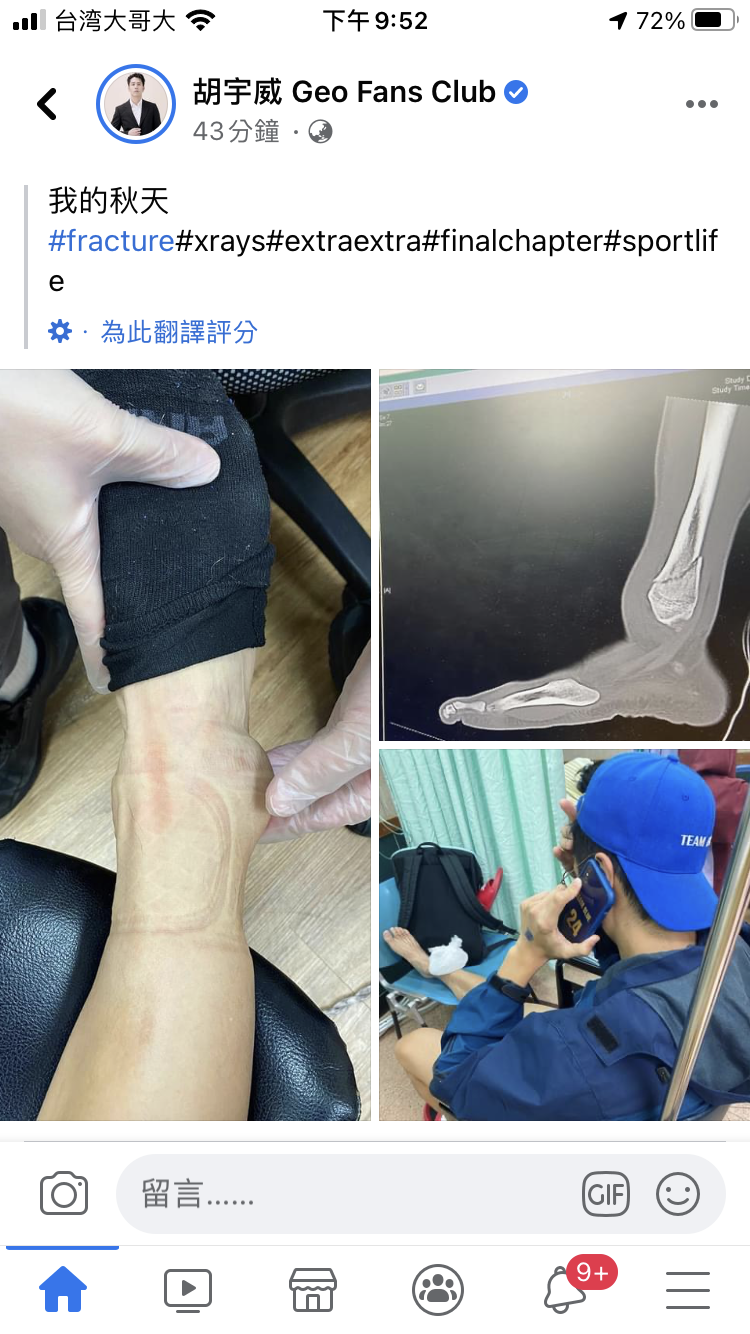 胡宇威今自主訓練時骨折就醫。（翻攝自胡宇威臉書）