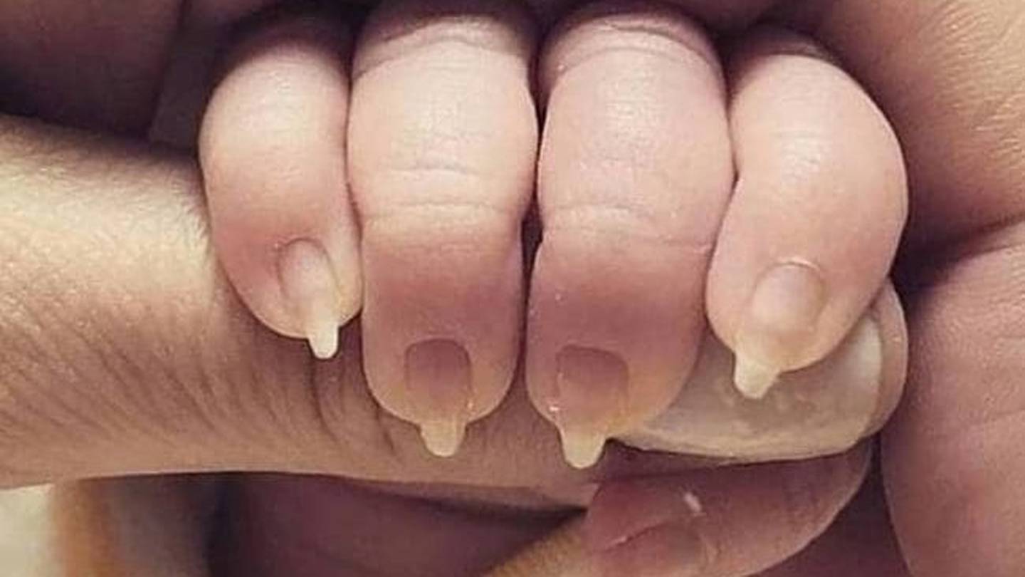 國外一名母親替寶寶修指甲，引起網友批評。（翻攝自Reddit） 