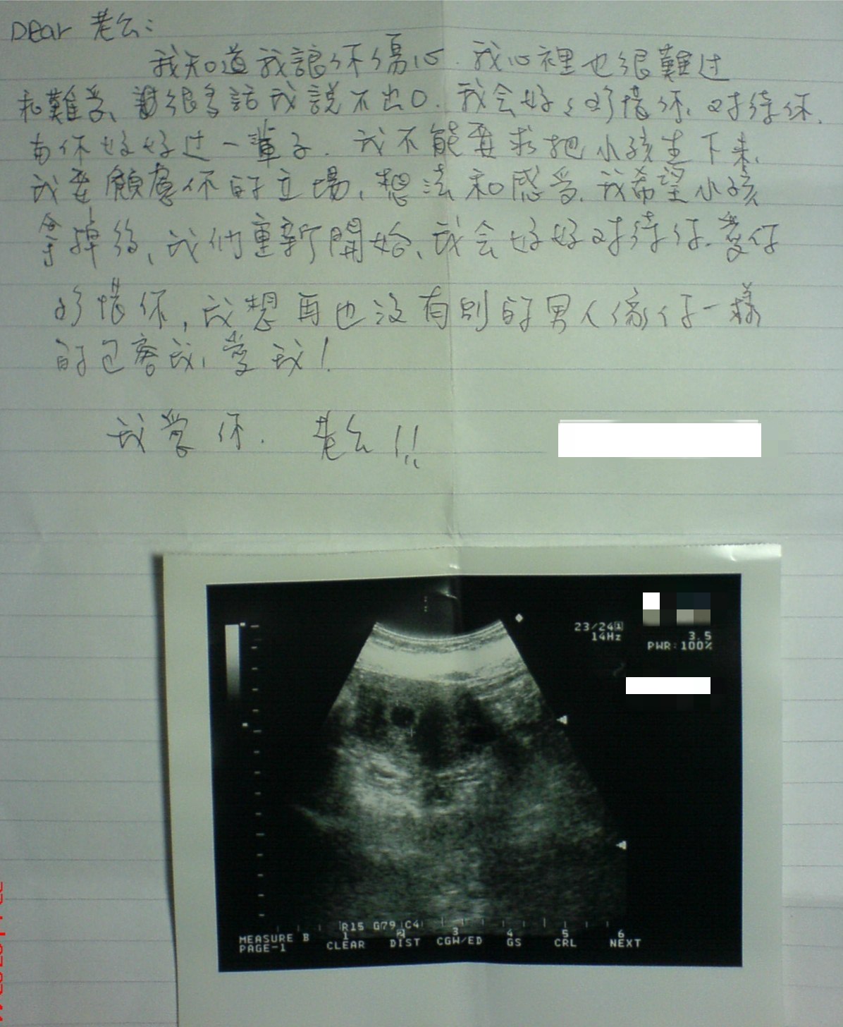 有人質疑發文的真實性，發文者拿出超音波照與女方的親筆道歉信，來證明所言非假。（翻攝自PTT）