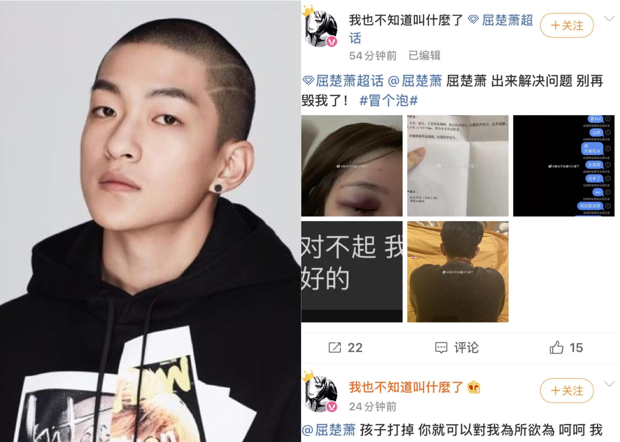 屈楚蕭感情再出包,自稱他女友的網友出面指控被毆打致流產,疑似遭男方友人毆打。(翻攝自屈楚蕭工作室、新浪微博)