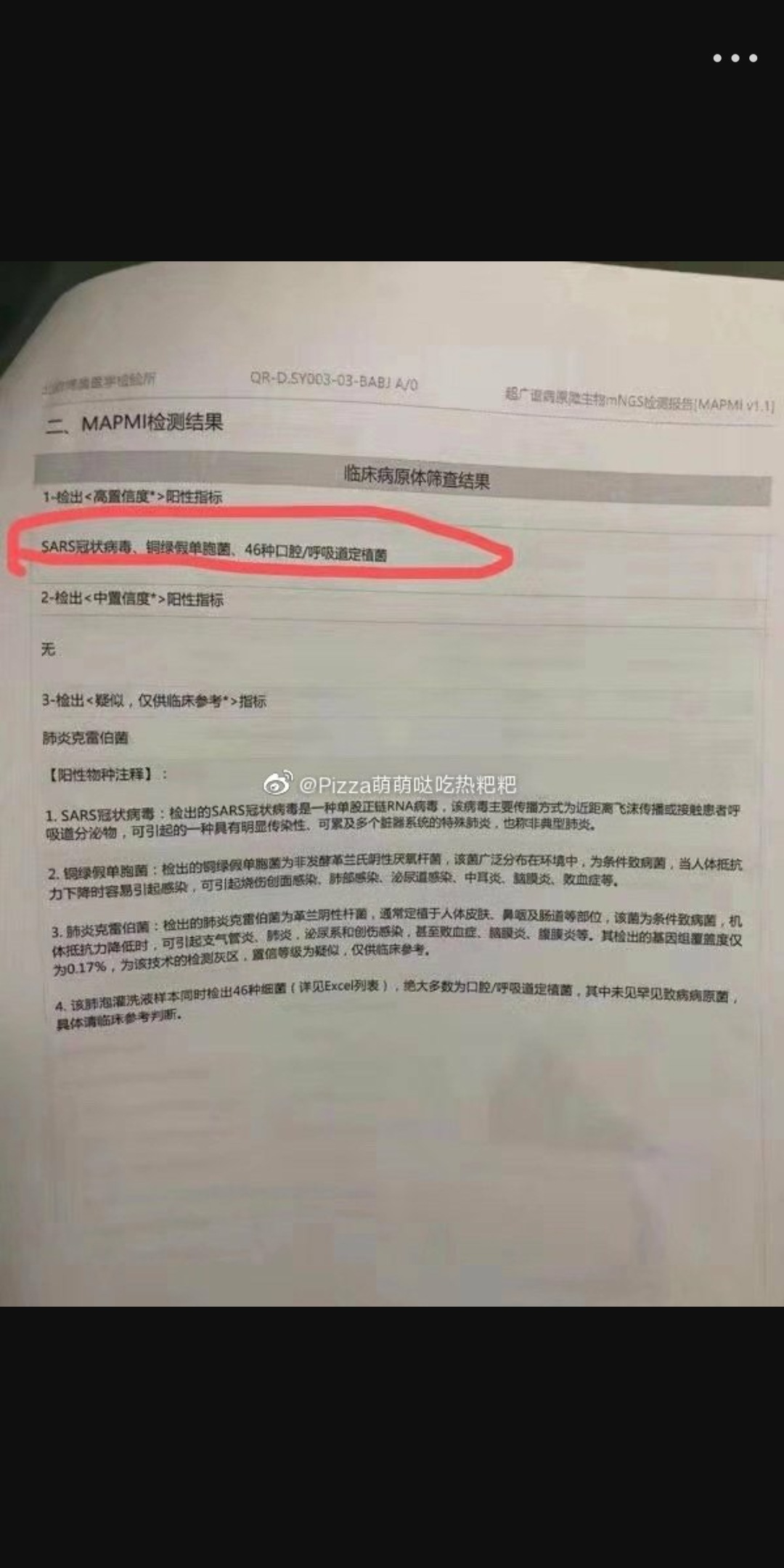 檢驗報告提到疑似SARS的反應結果。(翻攝自PTT)