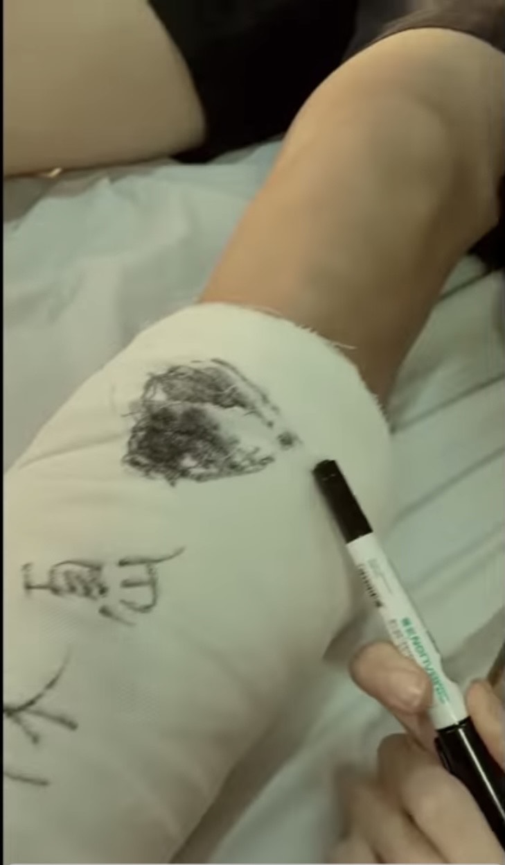 MV中，李宣榕還在胡宇威的左腳骨折石膏上劃上愛心。（翻攝自〈好好〉MV畫面）