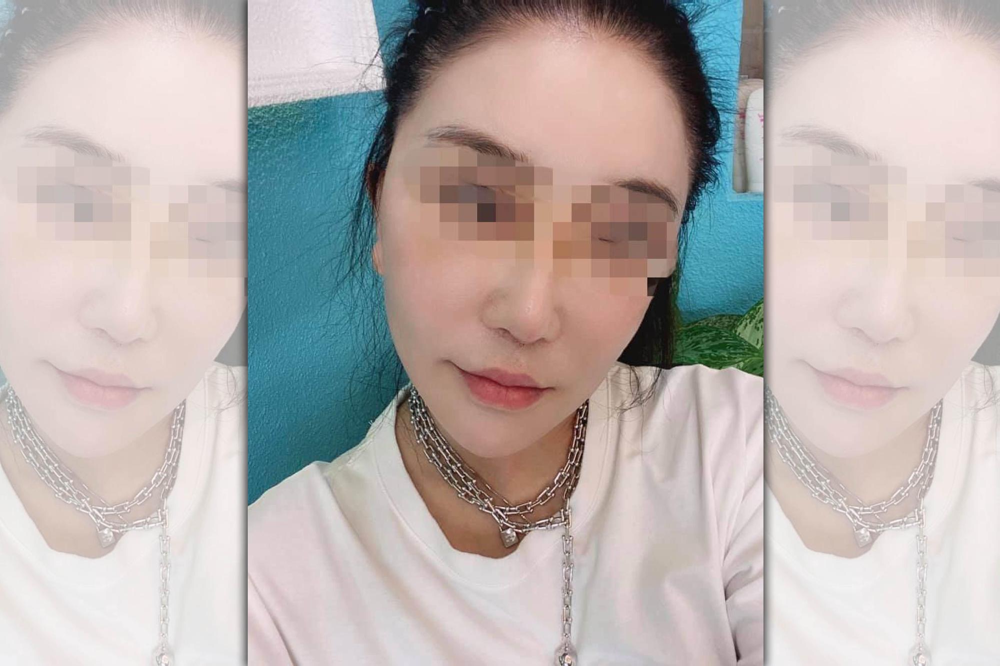 張姓醫美貴婦曾違法為客人進行微整形遭判刑。(翻攝畫面)