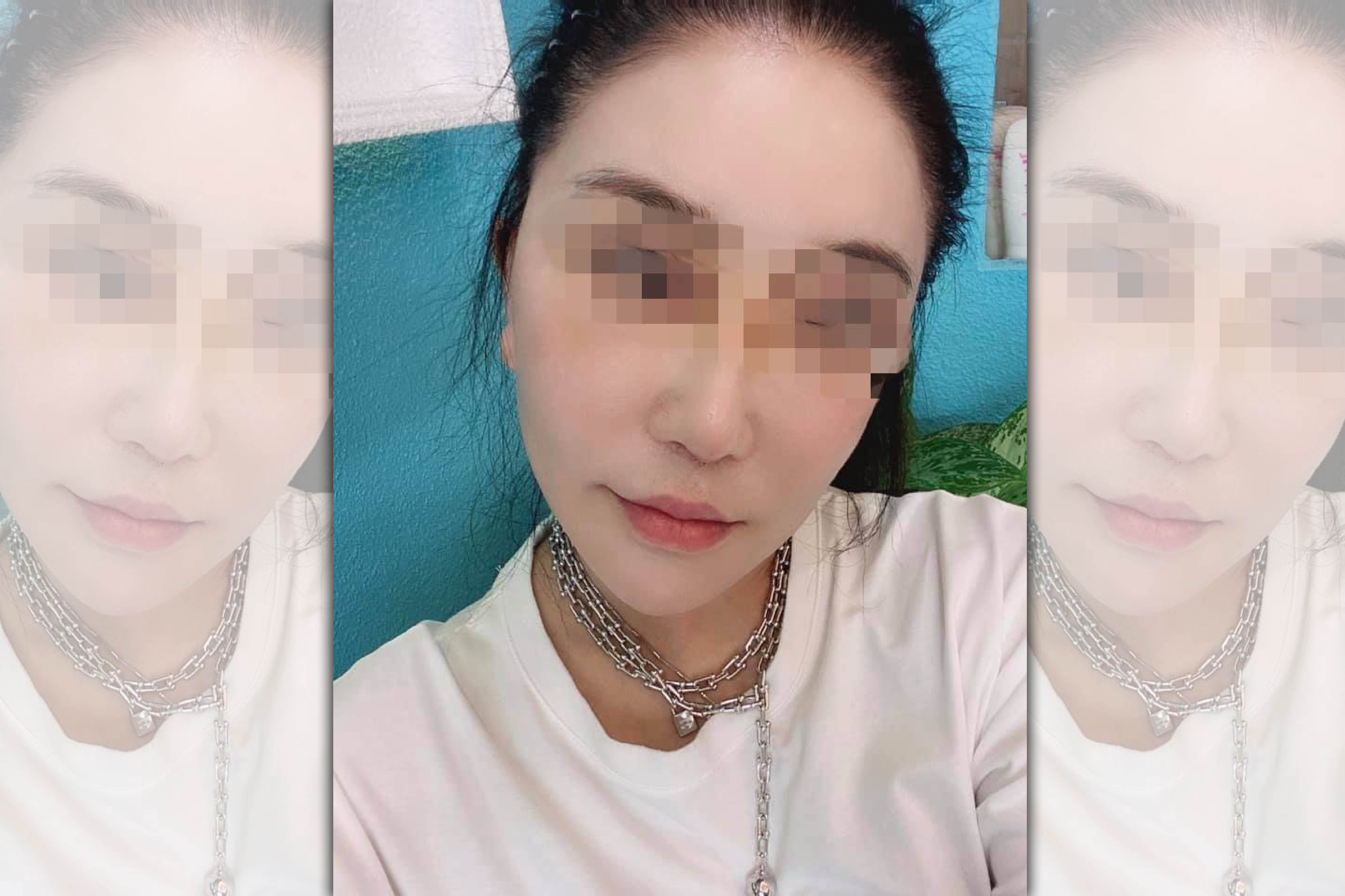 張姓醫美貴婦曾違法為客人進行微整形遭判刑。（翻攝畫面）