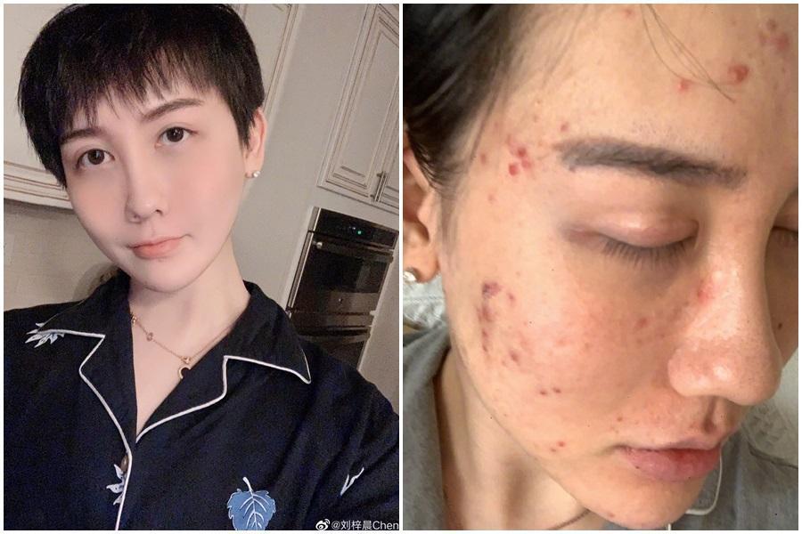中國話題網紅「蛇精男」劉梓晨在微博消失1個月,9日自爆感染武漢肺炎。(翻攝自劉梓晨微博)