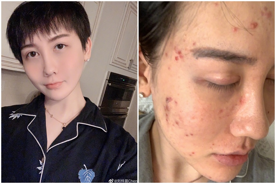 中國話題網紅「蛇精男」劉梓晨在微博消失1個月，9日自爆感染武漢肺炎。（翻攝自劉梓晨微博）