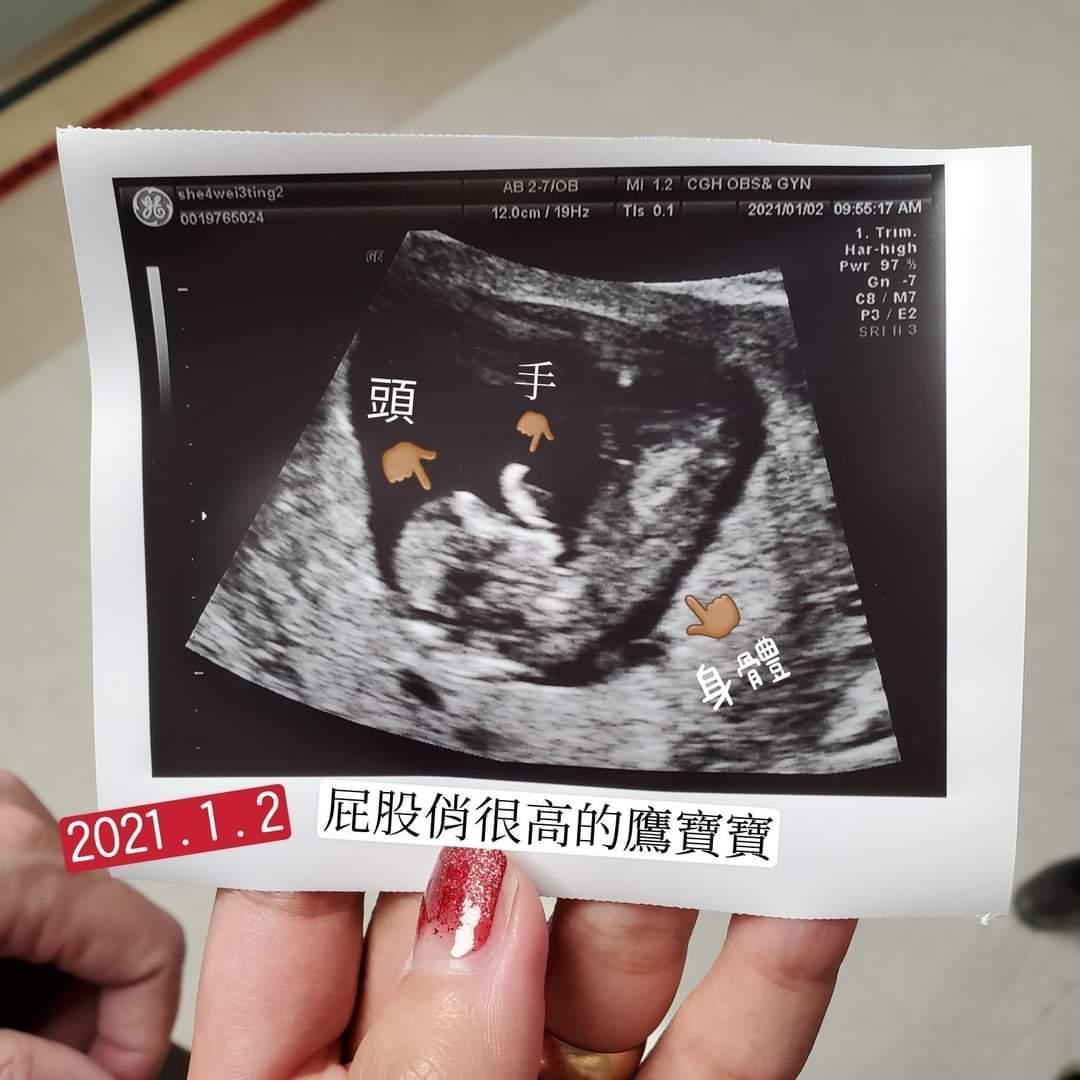 葉瑋庭開心宣布要當媽媽,曬出肚內寶貝的超音波照。(翻攝自葉瑋庭粉專)