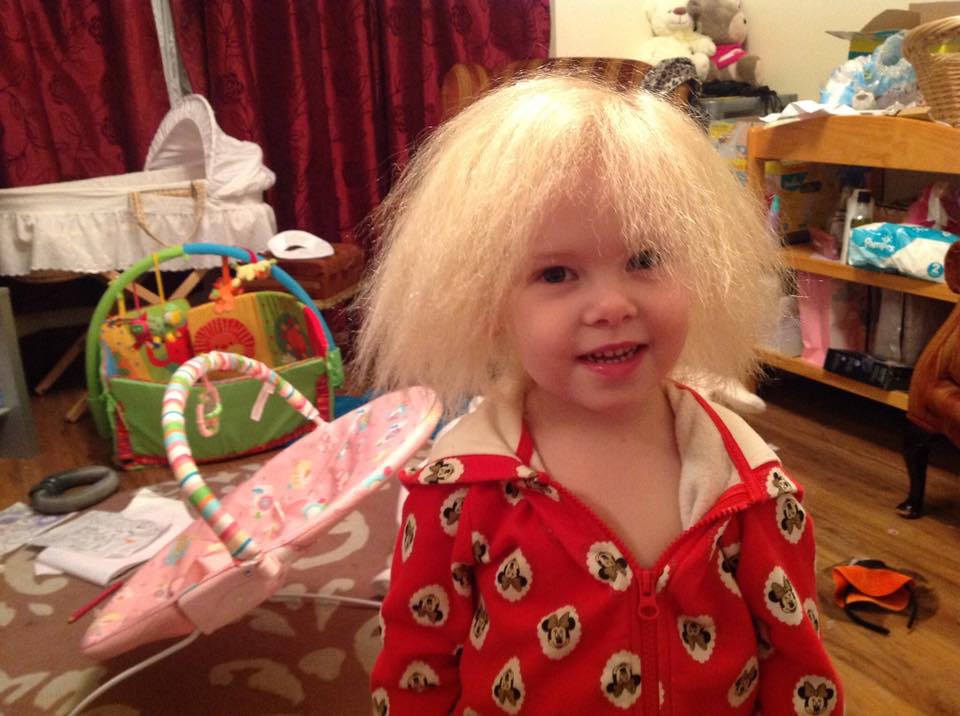 小萊拉天生擁有一頭梳不開的爆炸頭，原來她罹患罕見的「難梳頭髮綜合症」。（翻攝Lyla Grace Barlow臉書）