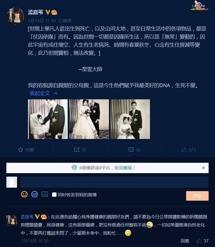 對網友是否「進廠維修」疑問,孟庭葦表示是自然老化的原因。(翻攝孟庭葦微博)