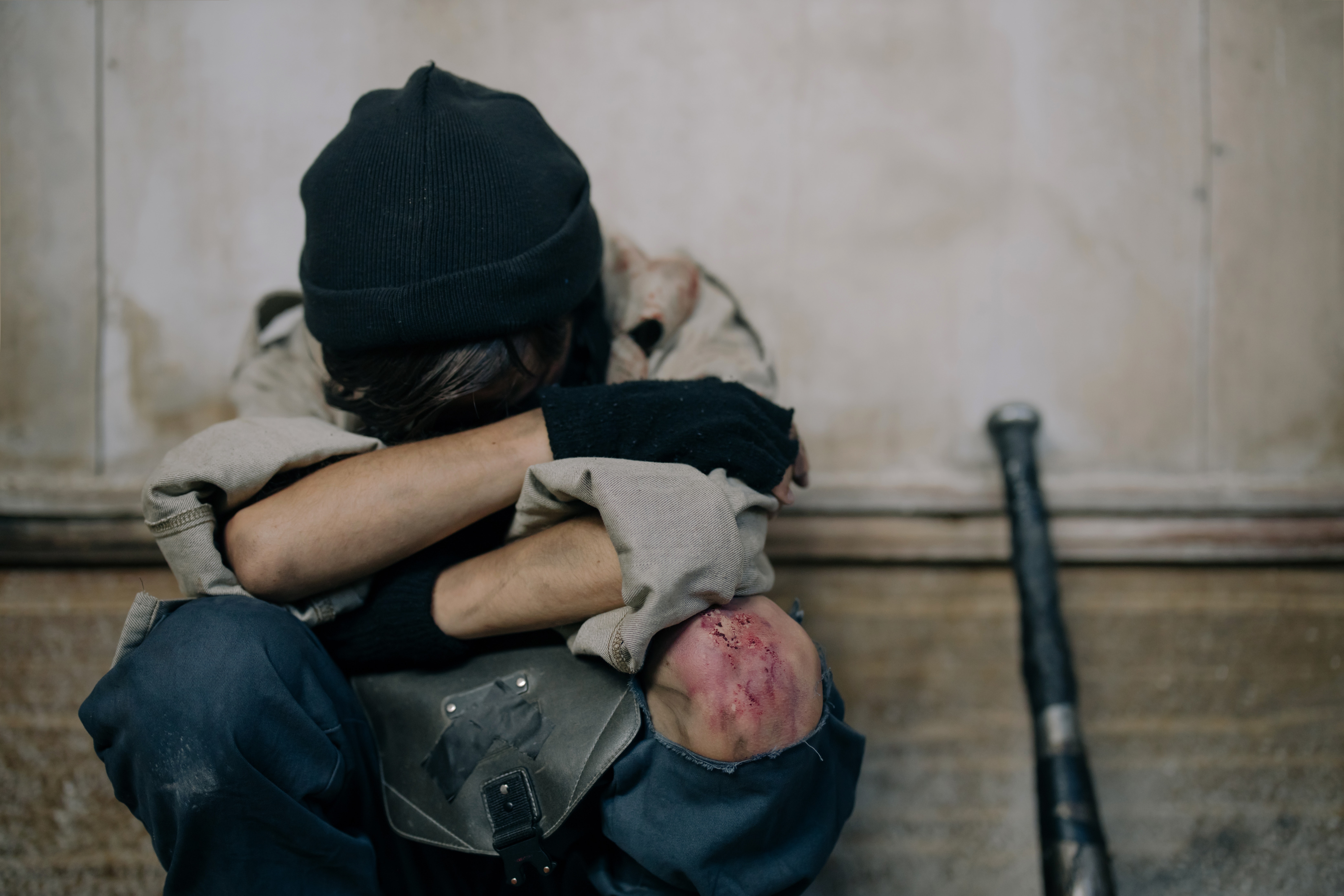 一名男網友因女友擅長散打、拳擊，身上總是傷痕累累。示意圖，非當事人。（攝影師：cottonbro，Pexels提供）