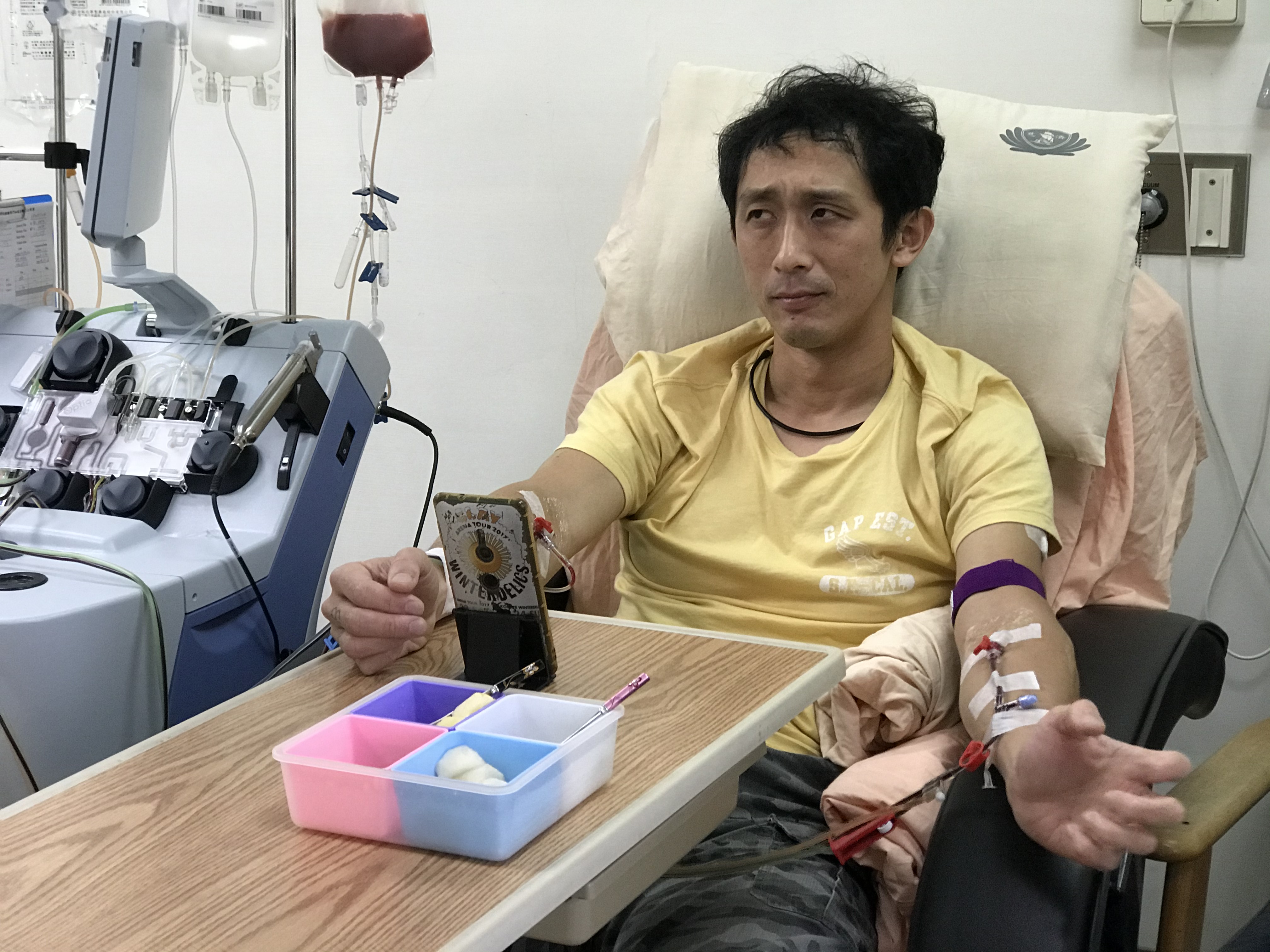 蔡豐燦以「採集周邊血收集造血幹細胞」為捐贈方式，當這次再度扎針時，他很清楚知道再次走進醫院不是為了自己，而是要救另一個人。（慈濟基金會提供）