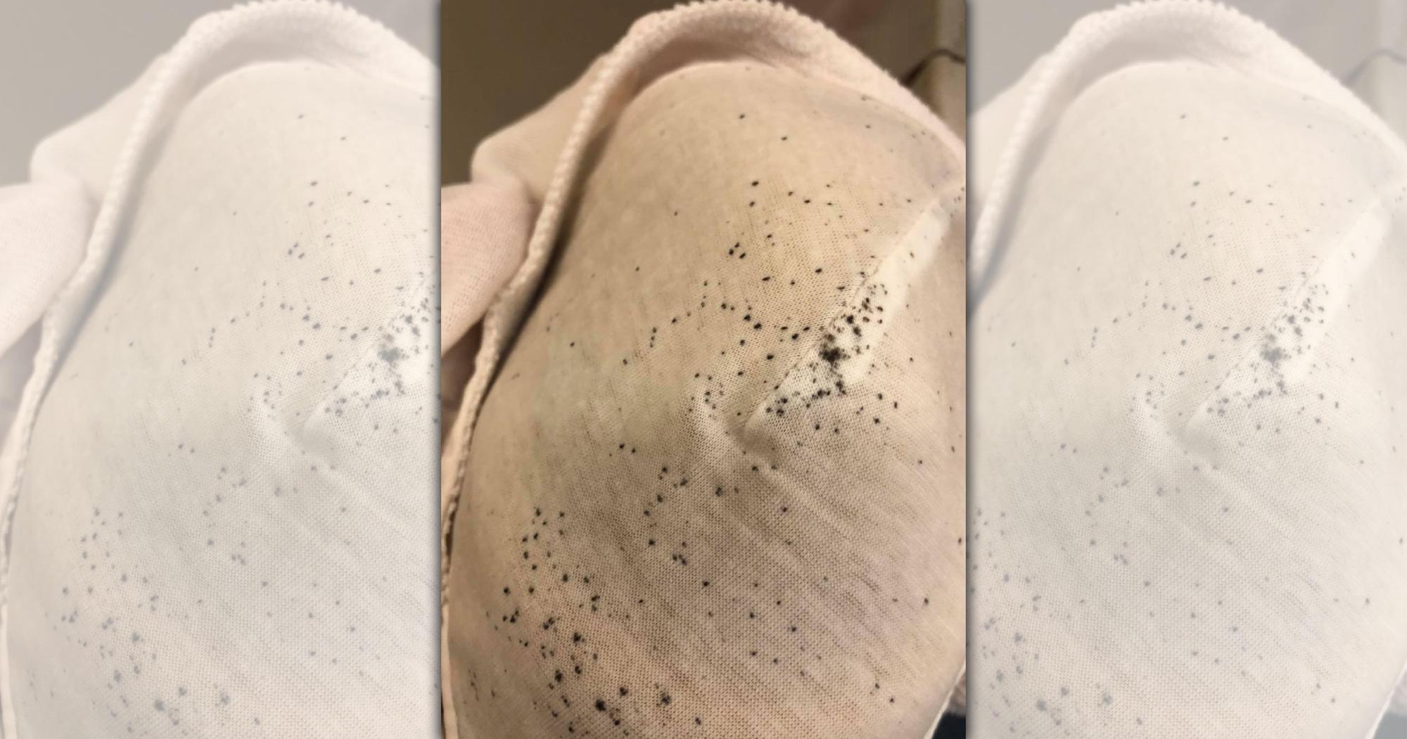 人夫秀出妻子沒破洞不用丟掉的「黑胡椒內衣」，讓皮膚科醫師也不禁規勸「母湯」。（翻攝自皮膚科醫師蔡逸姍臉書）