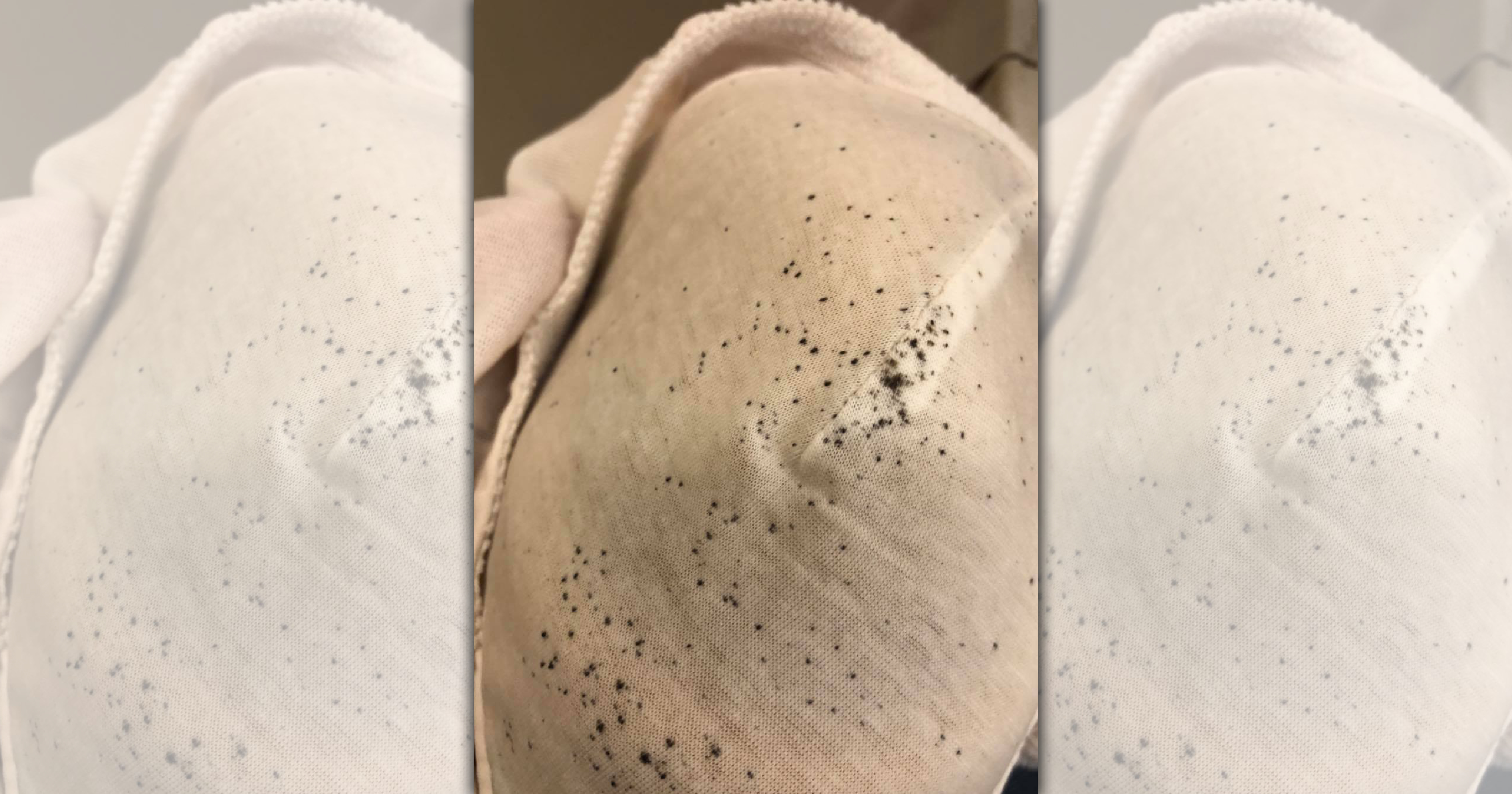 人夫秀出妻子沒破洞不用丟掉的「黑胡椒內衣」，讓皮膚科醫師也不禁規勸「母湯」。（翻攝自皮膚科醫師蔡逸姍臉書）