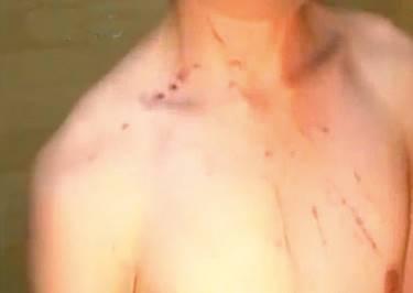 警方逮捕C姓少年時，他身上還留有不少死者的抓痕。（翻攝東森新聞）