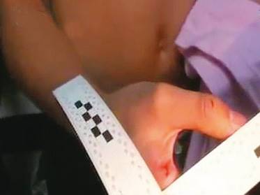 C姓少年持刀殺害丁女時,因用力過猛,自己手上也留下刀傷。(翻攝東森新聞)