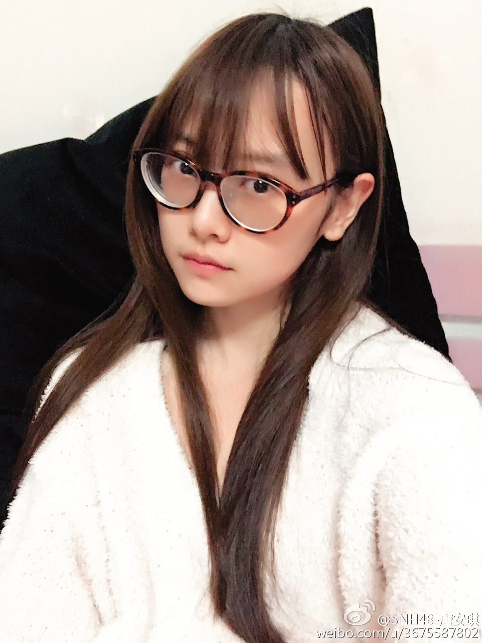 SNH48女團團員唐安琪，2016年在咖啡店發生火吻意外，如今仍在治療中。（翻攝自唐安琪微博）