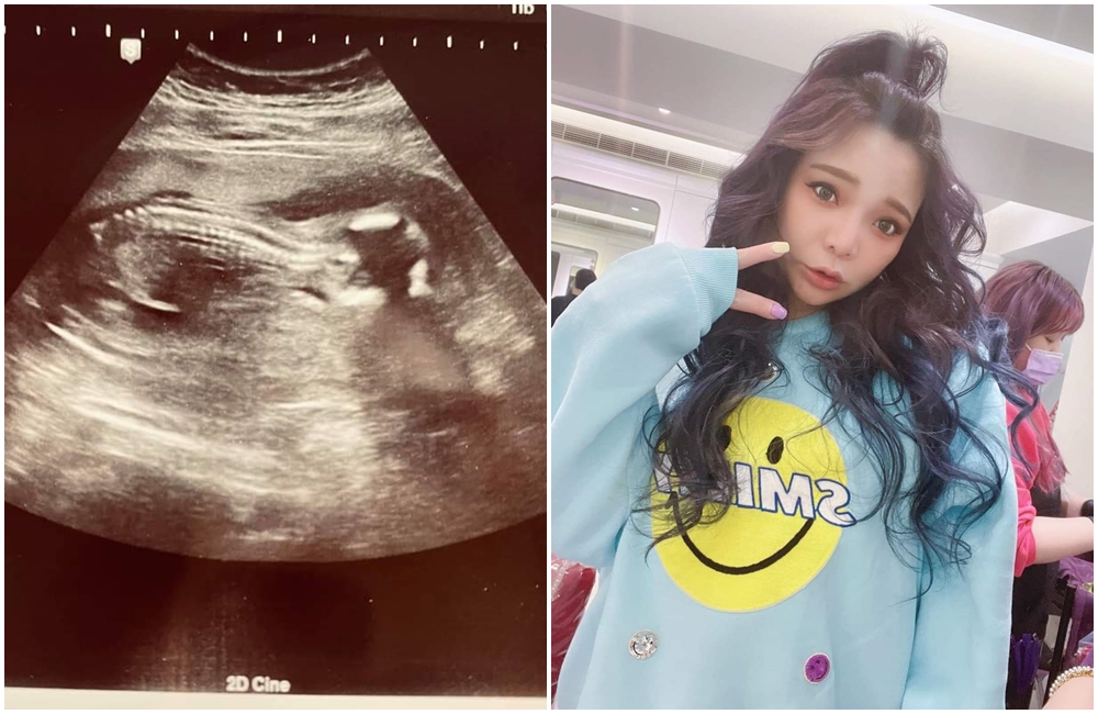 小甜甜公開超音波照片，肚子裡懷的是女寶寶。（翻攝自小甜甜粉專）