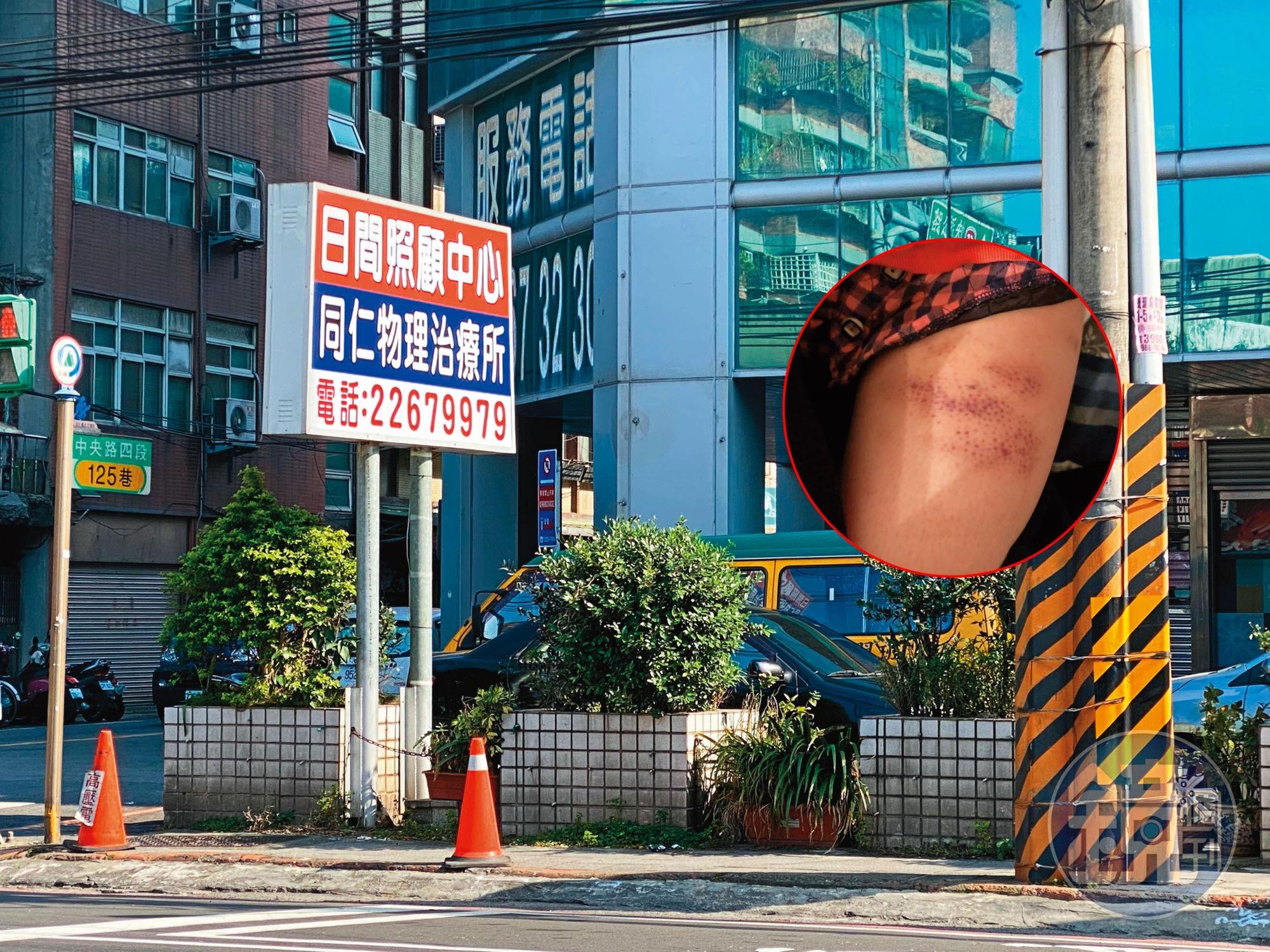 同仁醫院附設土城護理之家日間照顧中心,可收治近百床病患,規模不小。