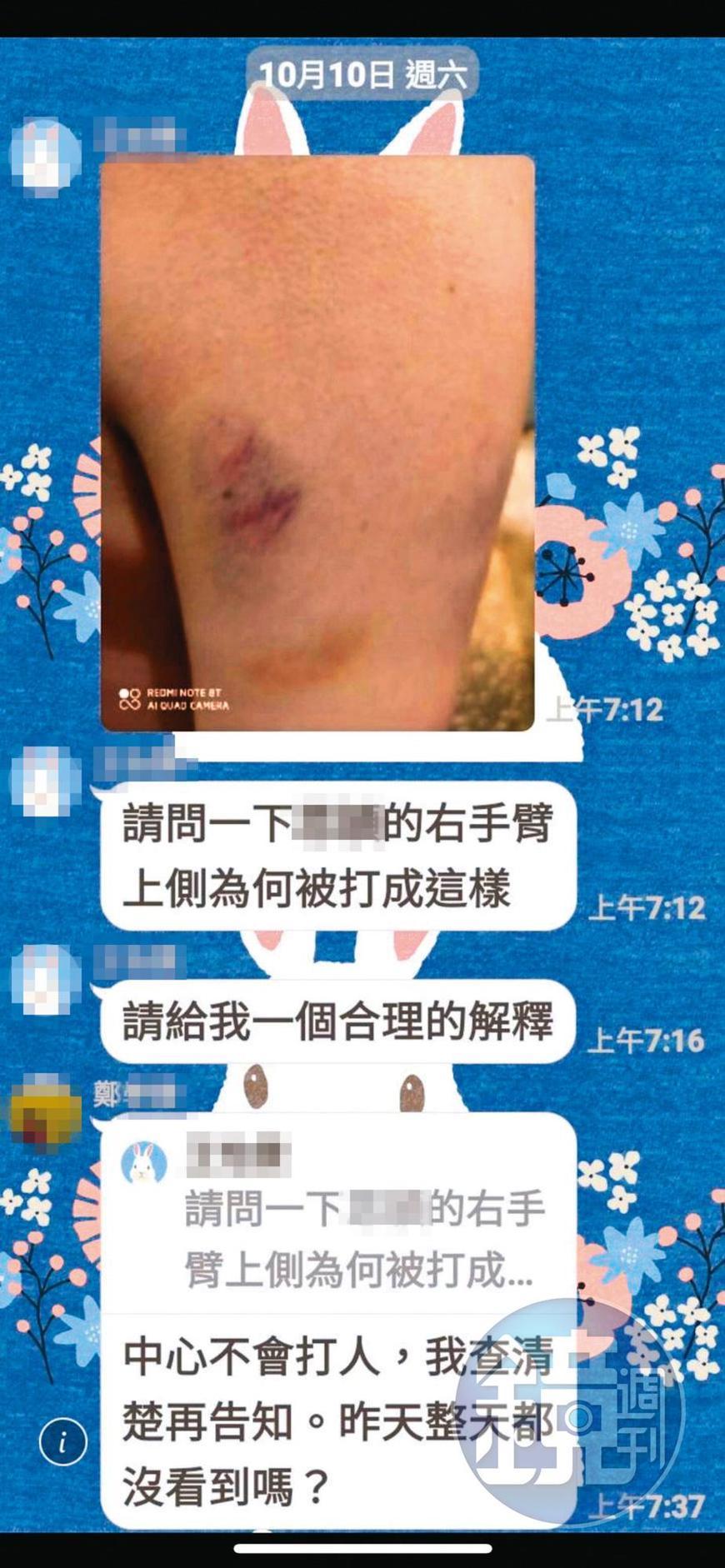 不只有小方身上出現不明瘀青,其他家長也曾在護理之家LINE群組反映類似情況,當時鄭姓主任強調中心不會打人。(讀者提供)