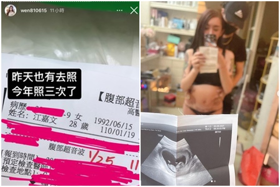 網紅「罔腰」曬高醫檢驗，表示自己懷孕。（翻攝自罔腰、罔腰男友IG）