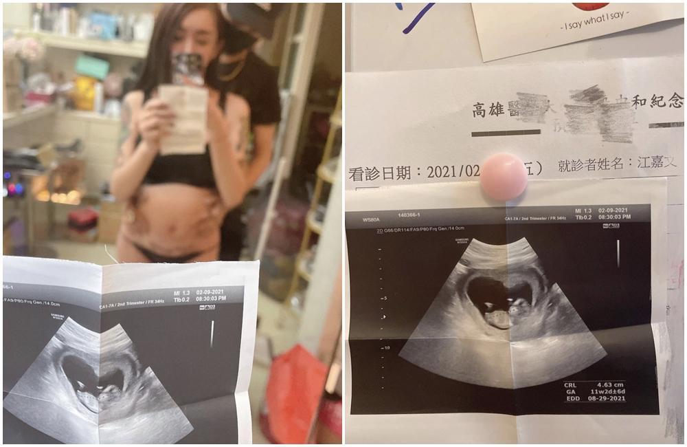 罔腰和男友宣布懷了小寶貝。(翻攝自罔腰IG)