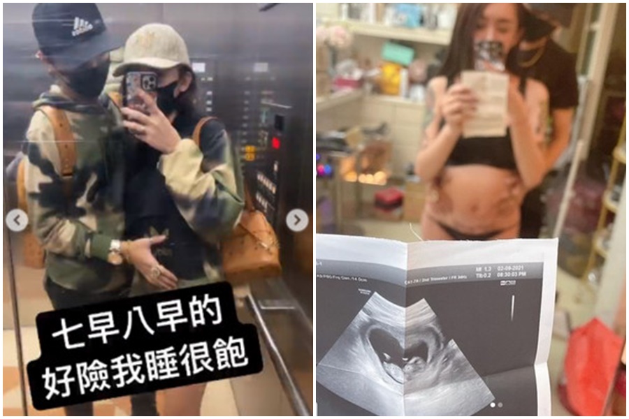 罔腰變性3年，昨在IG上曬超音波照引起關注。（翻攝自罔腰、罔腰男友IG）