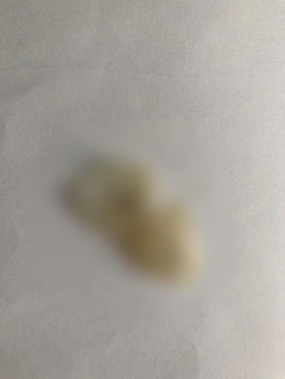 女網友表示，曾聽過保險套滑落在陰道內，但沒見過整個斷掉的情形。（翻攝自Dcard）