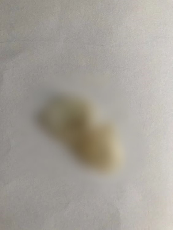 女網友表示,曾聽過保險套滑落在陰道內,但沒見過整個斷掉的情形。(翻攝自Dcard)