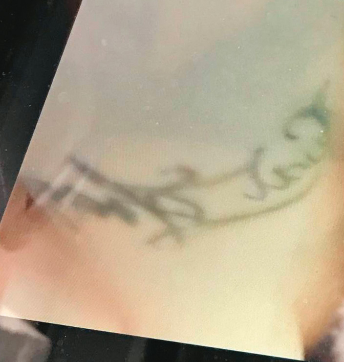 因為腰間的刺青（圖），小雯一眼就認出A片的男優就是自己的丈夫。（讀者提供）