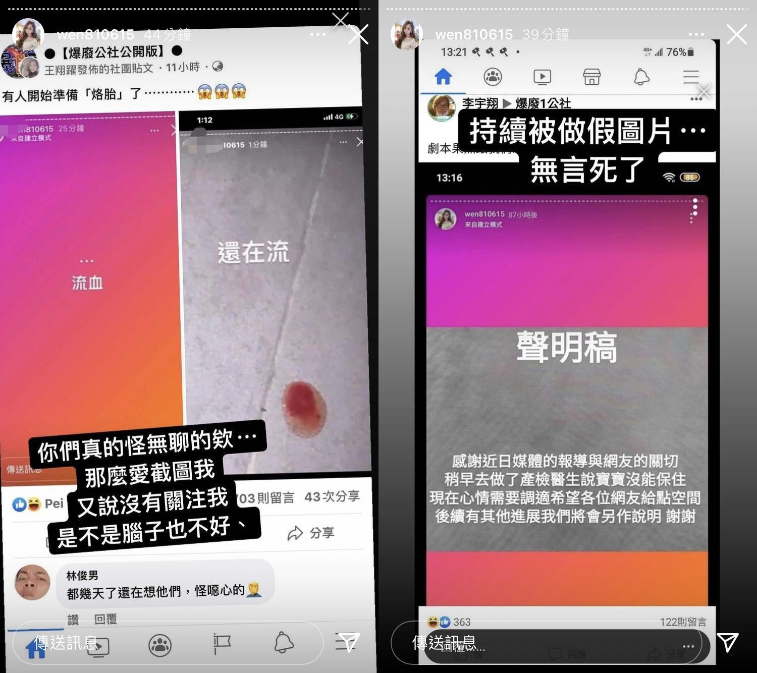 罔腰否認流產消息,表示是被做成假圖片。(翻攝自罔腰IG)