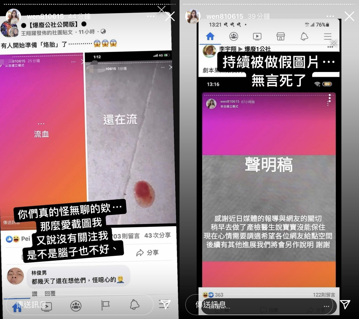罔腰否認流產消息，表示是被做成假圖片。（翻攝自罔腰IG）