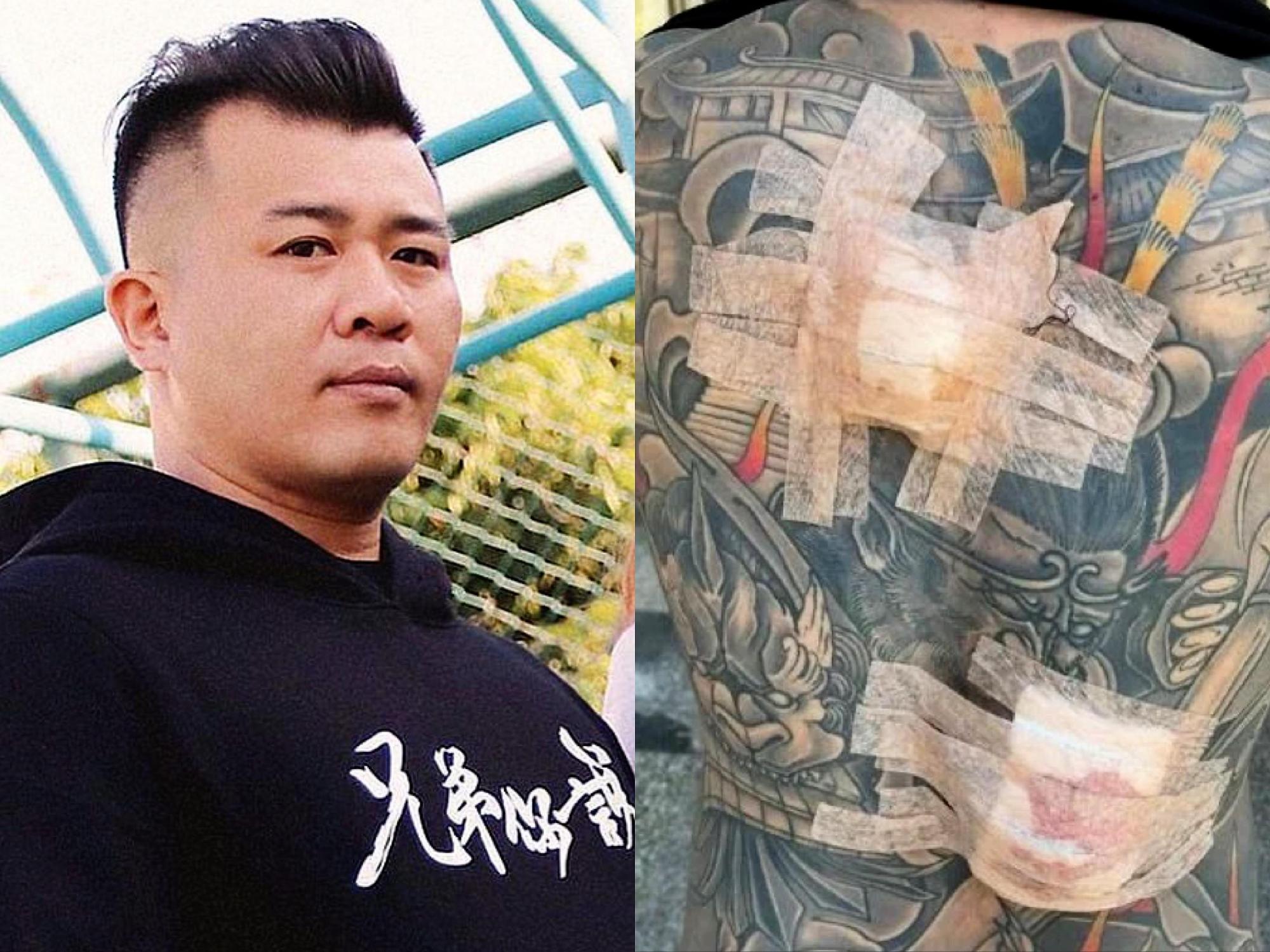 網紅超艾夾遭人無故刺傷,目前已無大礙返家休養。(翻攝自超艾這一家、含羞草日記臉書)