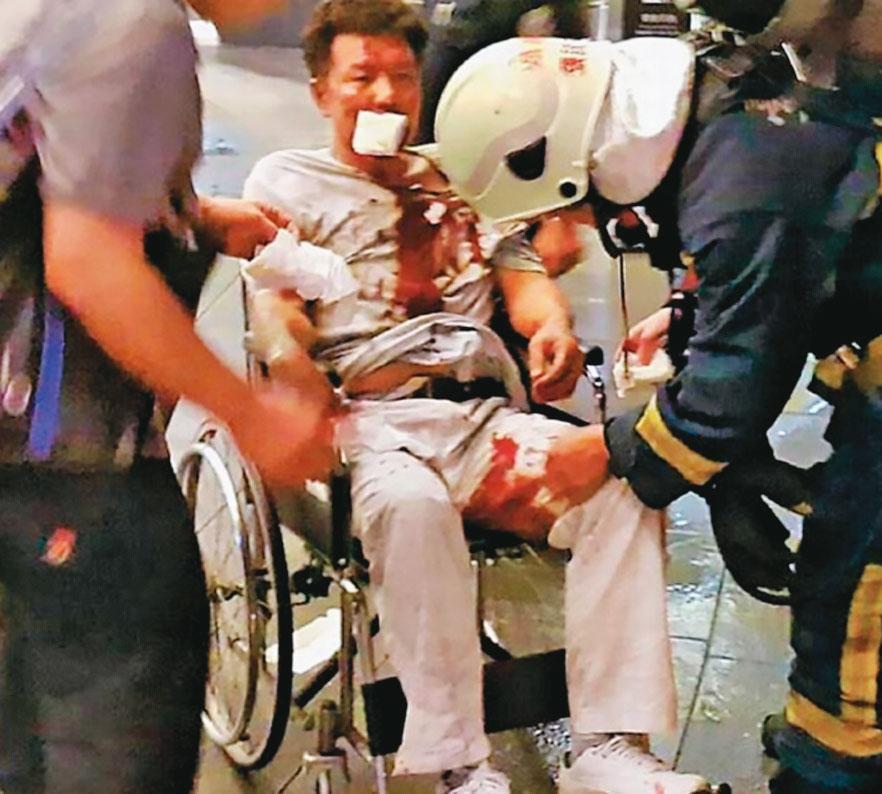 林英昌引爆炸彈後身受重傷,被送往醫院急救。(翻攝畫面)