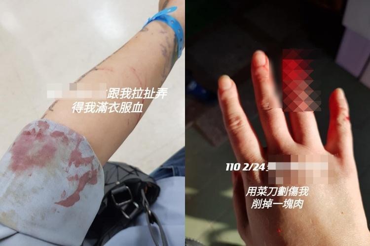 1名前空姐控訴遭到婆婆長期家暴，卻反遭婆家指控惡人先告狀。（翻攝自臉書社團爆料公社）