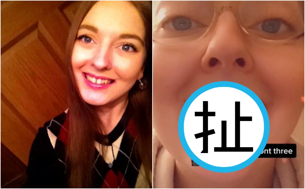 美國女子因為天天喝汽水，10年後上排牙齒幾乎全爛光。（翻攝自Victoria Irene Nowakowski臉書、抖音）